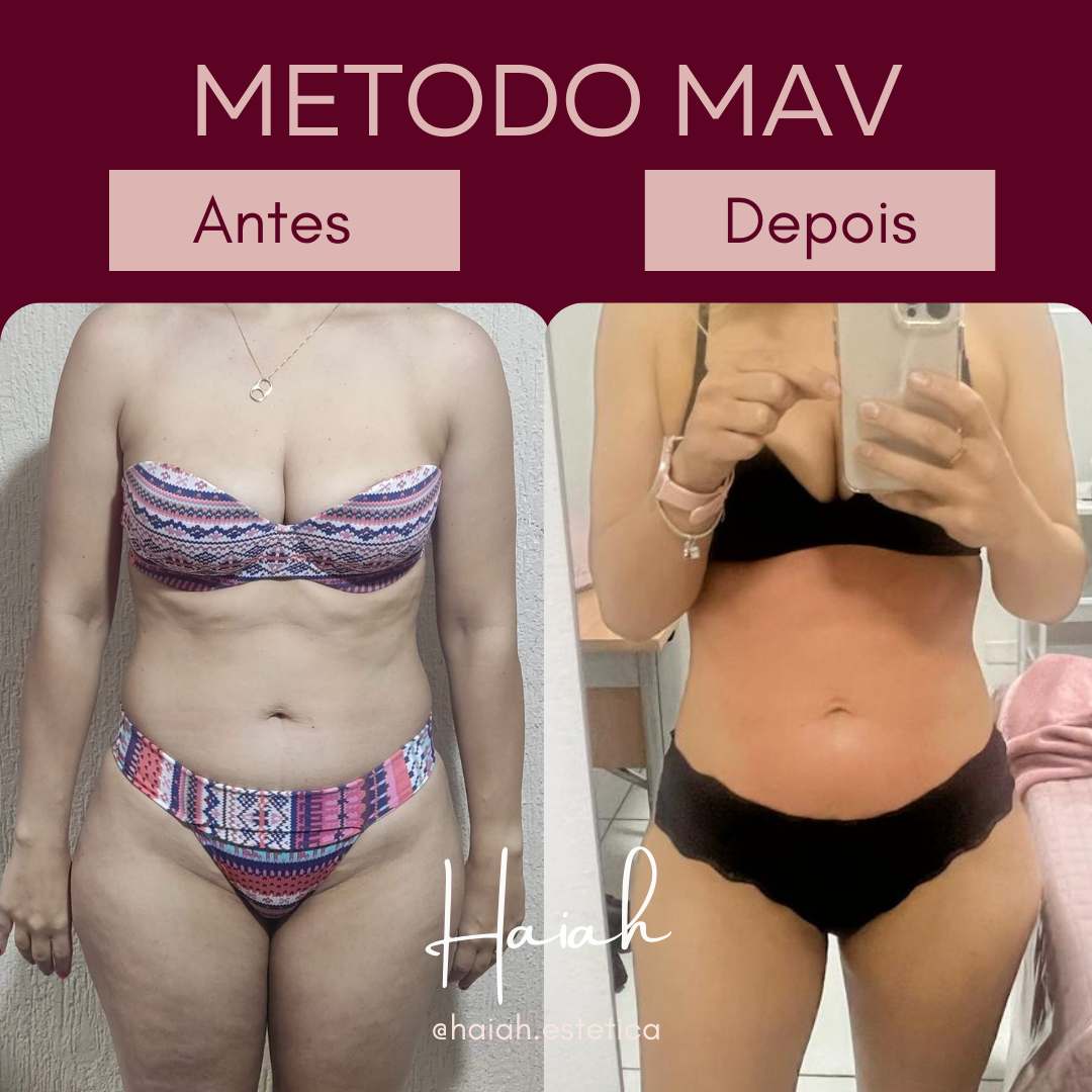 Antes e Depois HAIAH Post para Instagram - 108